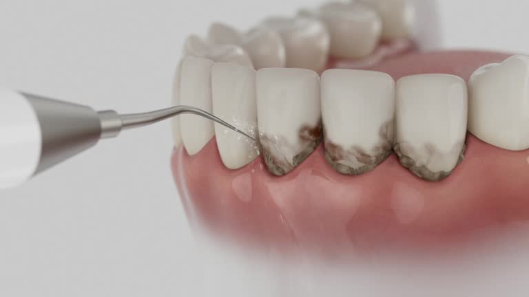 Reliable Dental Implants contractor in Stuarts Draft, VA by Smile Center Dentistry